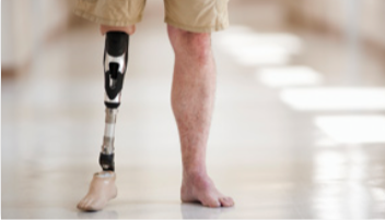 Protesis Ortopedia Camiloni